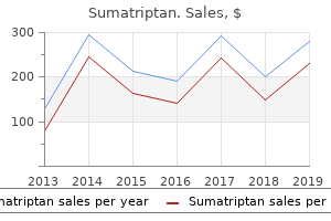 buy sumatriptan 25mg lowest price