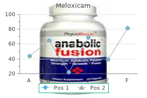 buy meloxicam 7.5 mg with mastercard