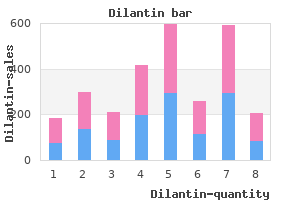 order dilantin on line amex