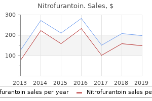 cheap nitrofurantoin 100mg free shipping