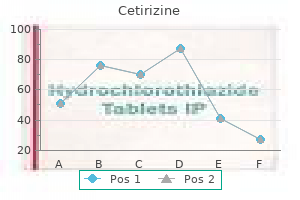 buy generic cetirizine 10mg line