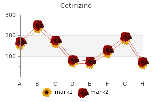 cheap cetirizine online amex