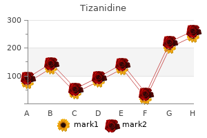 order cheapest tizanidine and tizanidine