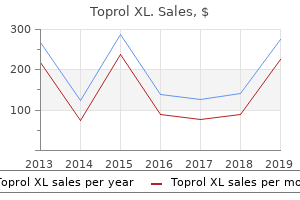 buy 100mg toprol xl with amex